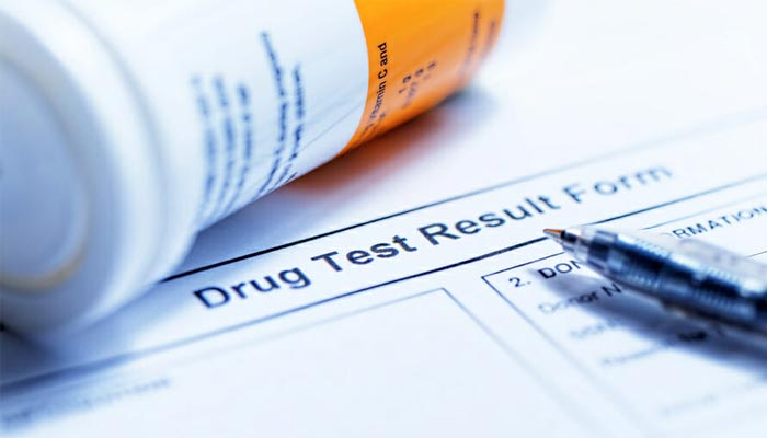 Does Verizon Drug Test New, Temporary or Corporate ...